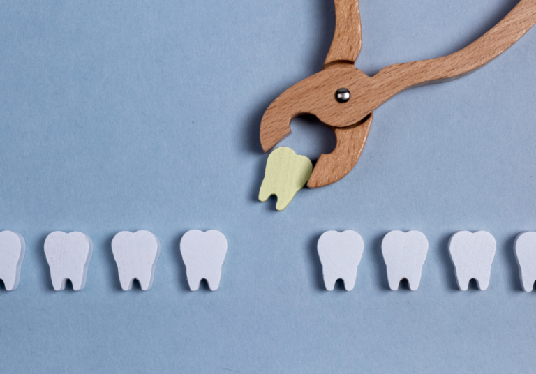 Remove Tooth