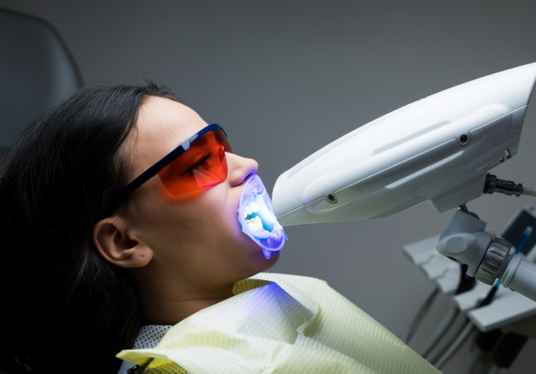Teeth Whitening Teeth Whitening